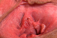 Pussy My Gape Discount Links s3